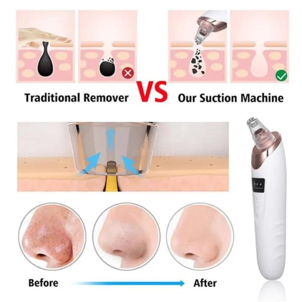 Blackhead Remover  and Pores Cleaner For Nose & Face